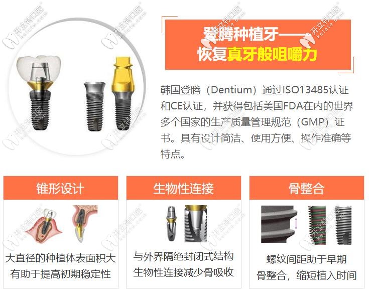 韓國(guó)登騰種植牙質(zhì)量怎么樣