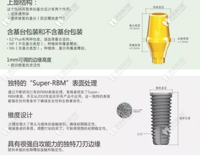 韓國(guó)美格真種植體的優(yōu)點(diǎn)