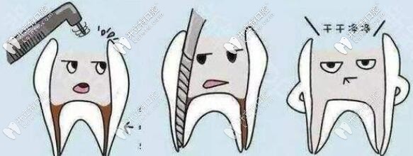 根管治療圖片
