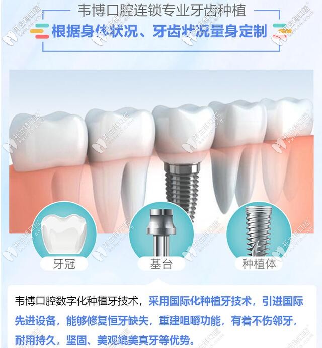 深圳韋博口腔種植牙更專業(yè)