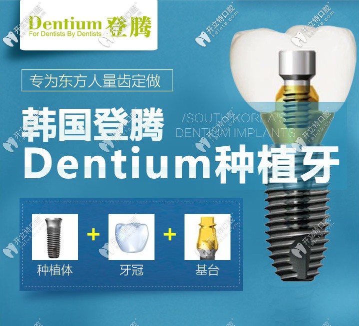 南京做韓國登騰種植牙多少錢？它的使用壽命有多長呢？