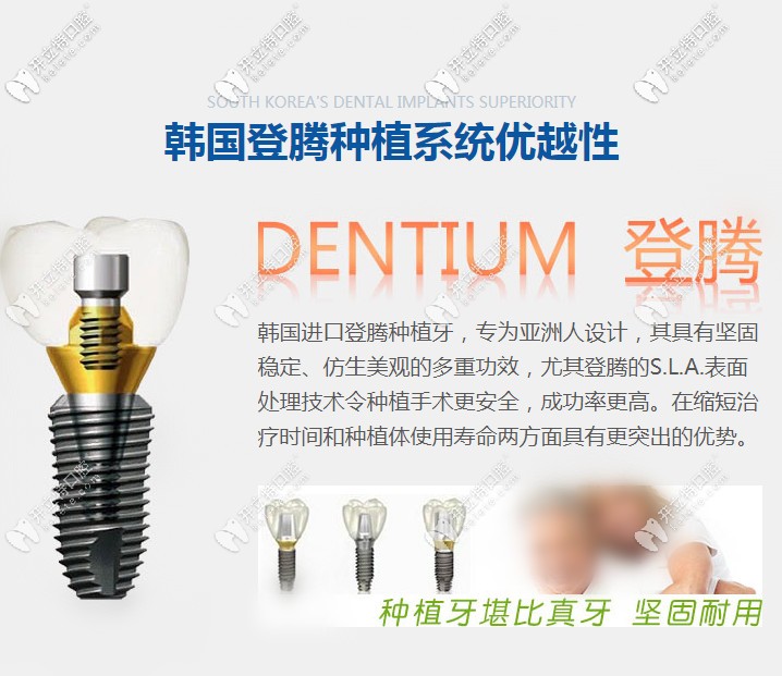 韓國登騰種植牙的優(yōu)勢(shì)