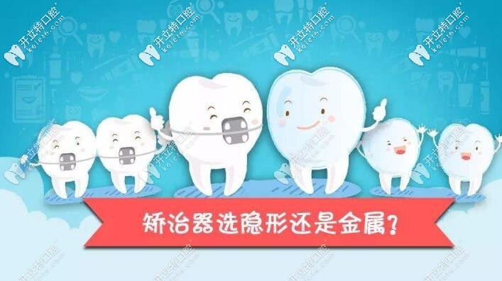 金屬自鎖和隱形矯正哪個好