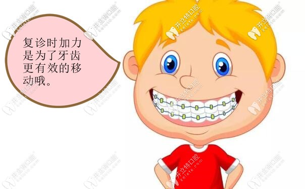 復診時加力更換弓絲