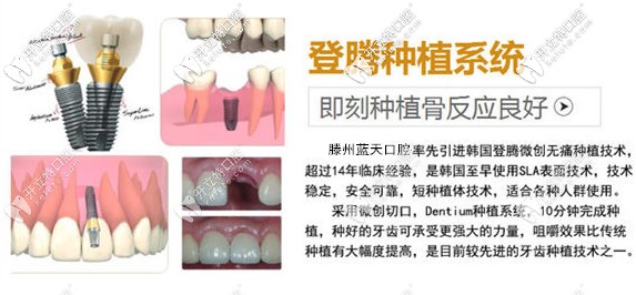 登騰種植體的特點