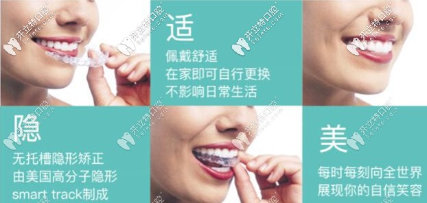 隱適美隱形牙套