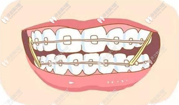 白麗鵬醫(yī)生的擅長項目介紹 白麗鵬醫(yī)生的擅長項目介紹