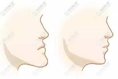 長沙地包天矯正做的好的醫(yī)院名單，兒童成人都有