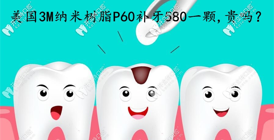 在煙臺做美國3MP60納米樹脂補牙580一顆，這費用算貴嗎