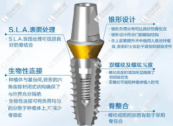 登騰種植體的優(yōu)勢
