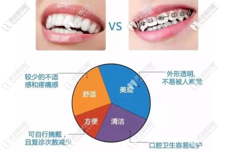金屬牙套和隱形牙套哪個(gè)好