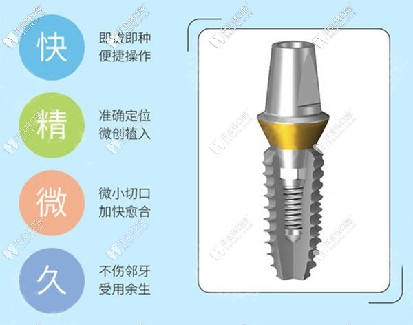 美國皓圣種植體2500元一顆靠譜嗎?中端檔次+質(zhì)保5年+壽命20年