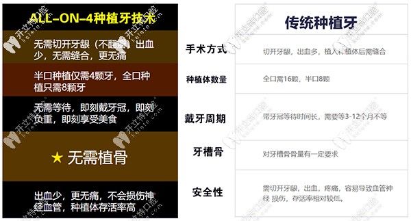 All-on-4速導(dǎo)種植牙相比較于傳統(tǒng)種植牙優(yōu)勢