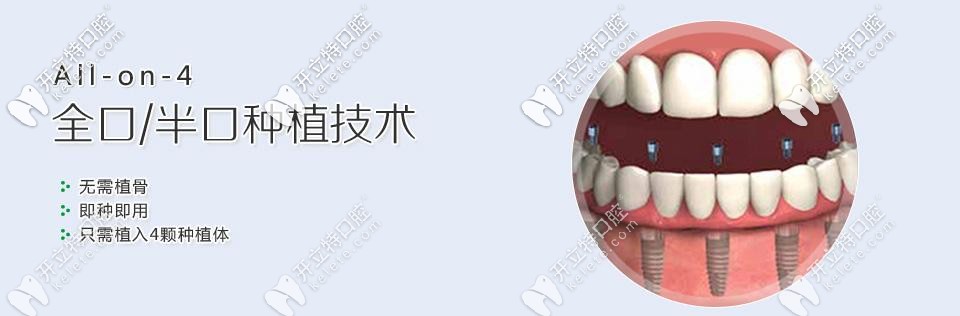 韓國奧齒泰種植系統(tǒng)ALL-ON-4全口種植牙價格在15萬起