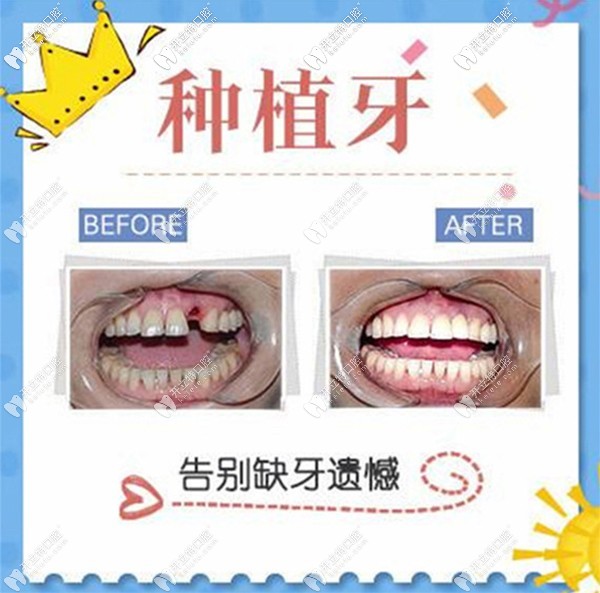 北京維嘉口腔價格表6家分店通用~遠(yuǎn)大路店/通州萬達(dá)店