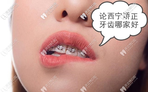 進(jìn)來(lái)聊聊關(guān)于西寧市做牙齒矯正哪家牙科醫(yī)院好這個(gè)話(huà)題