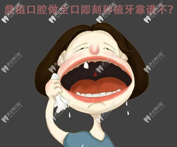 誰(shuí)做過即刻種植牙啊,在上海鼎植口腔做這種全口的靠譜不