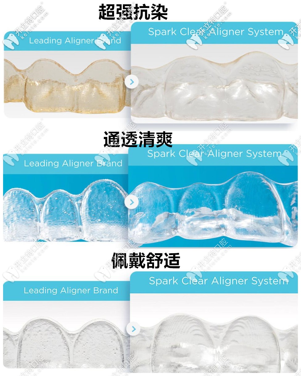 美國spark公司的ormco隱形矯正特點