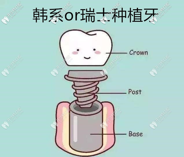 韓系和瑞士的價格差多少