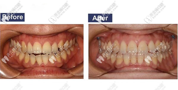 20201027727783.jpg QQ截圖20201027101726.jpg