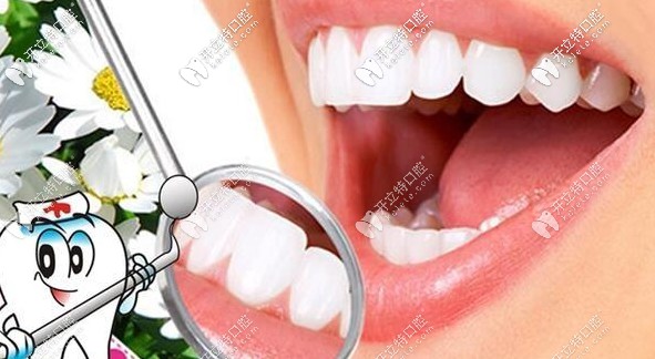 牙齒貼面效果圖