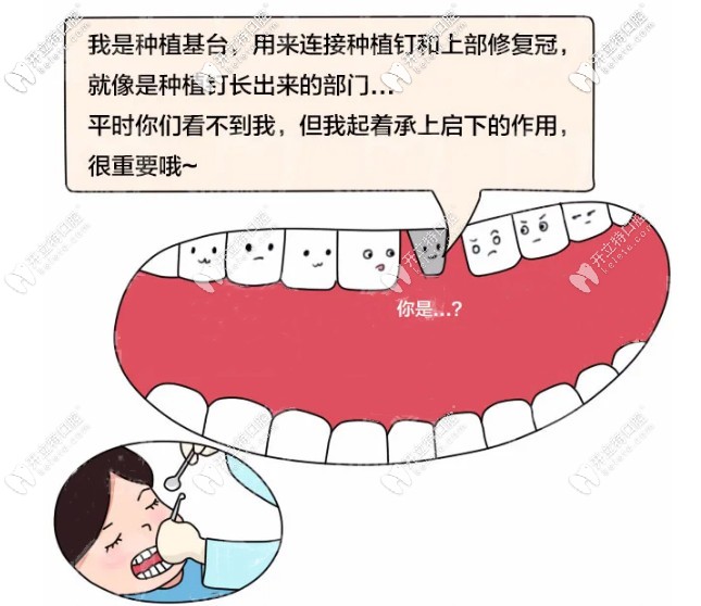 選擇種植體很重要