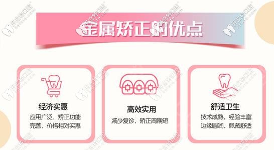 金屬托槽矯正優(yōu)點(diǎn)