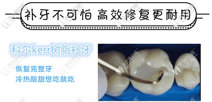 美國科爾kerr樹脂補(bǔ)牙多少錢一顆,與3m價(jià)位相差大嗎？