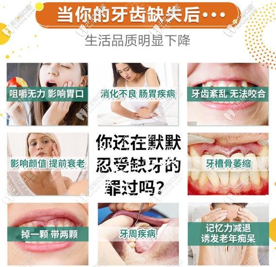 缺牙危害不能拖要及時醫(yī)治