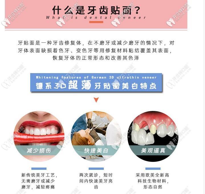 牙齒貼面及其特點(diǎn)介紹 牙齒貼面及其特點(diǎn)介紹