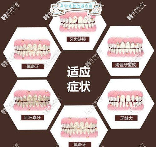 尤樂(lè)平醫(yī)生的擅長(zhǎng)項(xiàng)目介紹