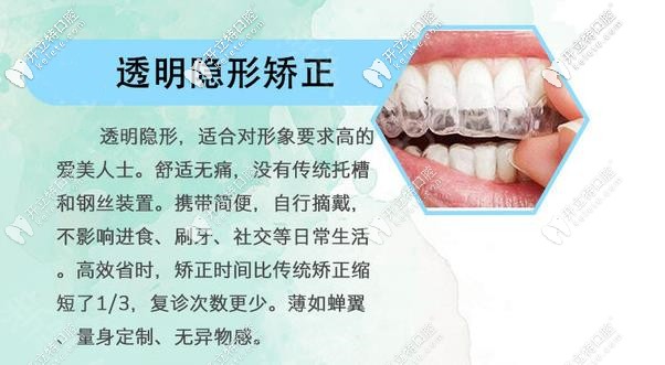 全隱形牙套優(yōu)勢