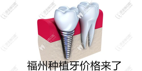 福州口碑好的牙科醫(yī)院排名前20,有維樂/美可普/福能海峽口腔