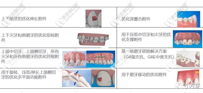 SmartForce附件主要用于哪些部位