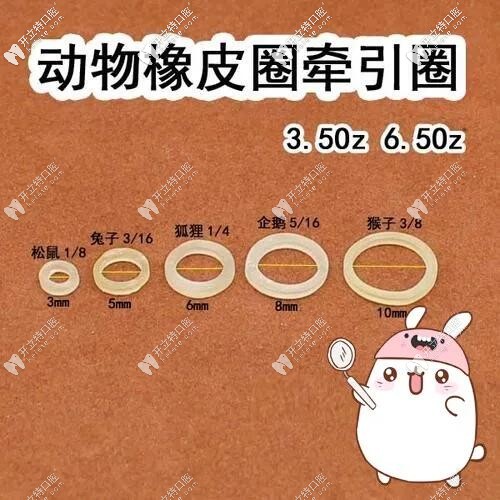 正畸橡皮圈型號(hào)和力量