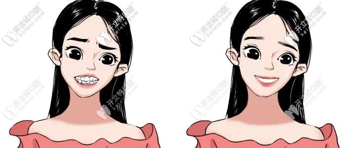 整完牙都變漂亮了呢！