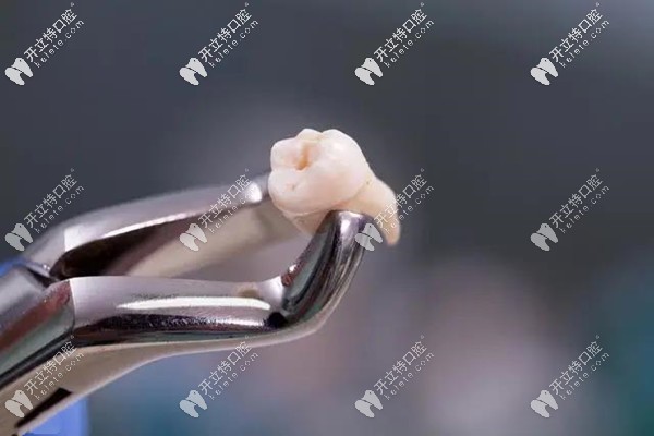 高血壓拔牙有什么風險