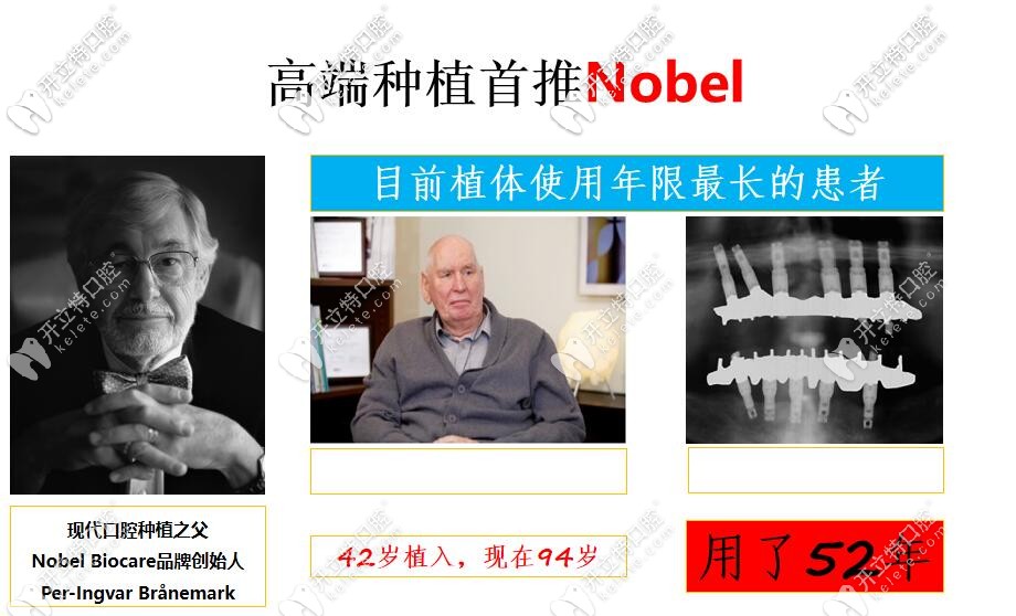 除了價格,世界十大種植體品牌的排行榜及其優(yōu)缺點也要了解