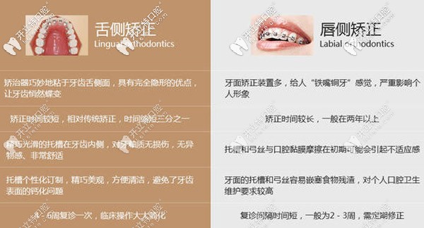 舌側(cè)和唇側(cè)矯正的對比