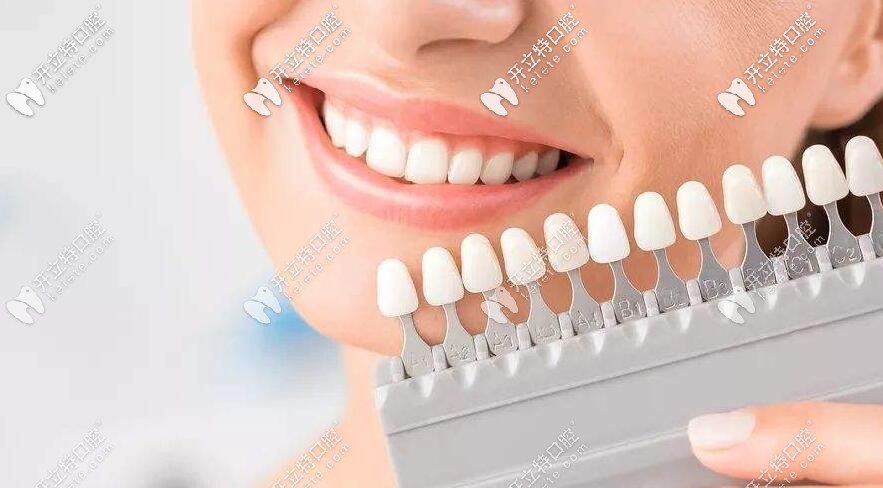 牙齒顏色對照表怎么看,深度剖析各種牙齒顏色