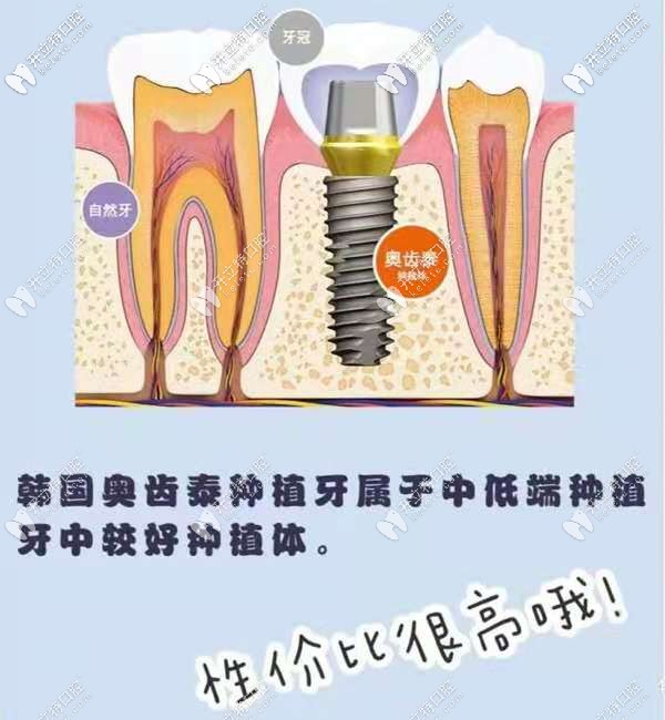 長(zhǎng)沙韓德口腔做韓國奧齒泰優(yōu)惠