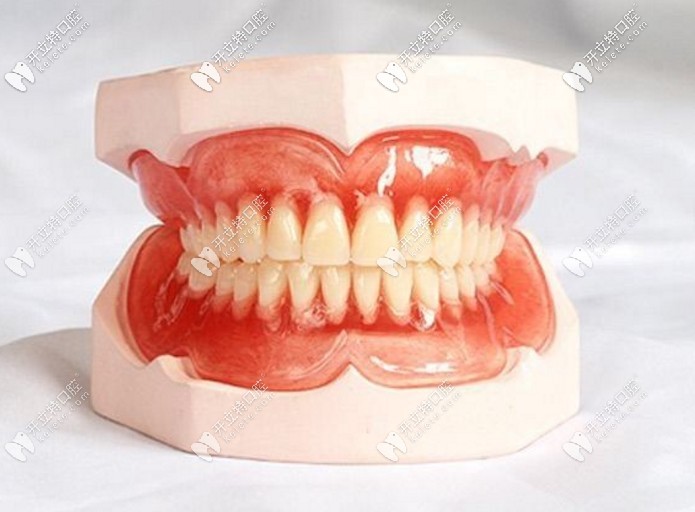 吸附性全口義齒 吸附性全口義齒