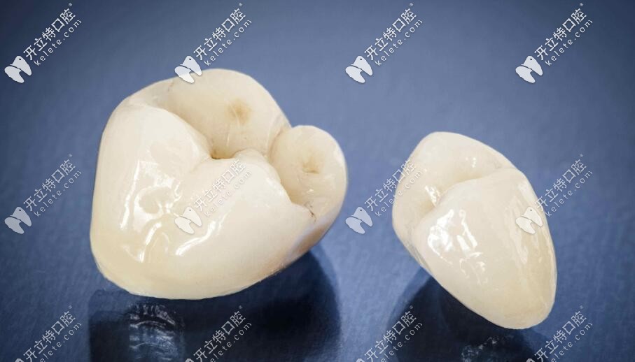 問:紫晶全瓷牙屬于哪個(gè)國家的材料,它的優(yōu)勢(shì)在哪