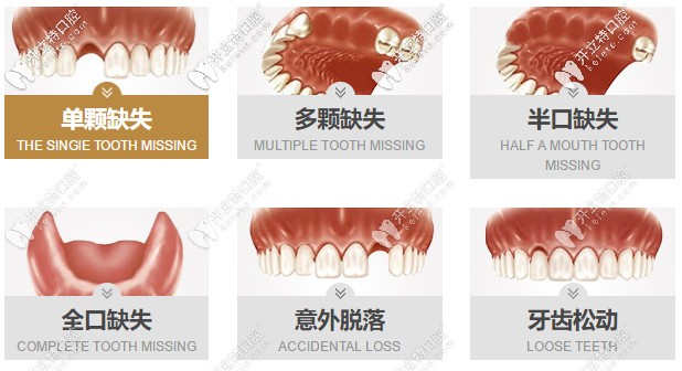 找這份合肥貝杰口腔做種植牙的價(jià)格表不容易，請(qǐng)珍惜~