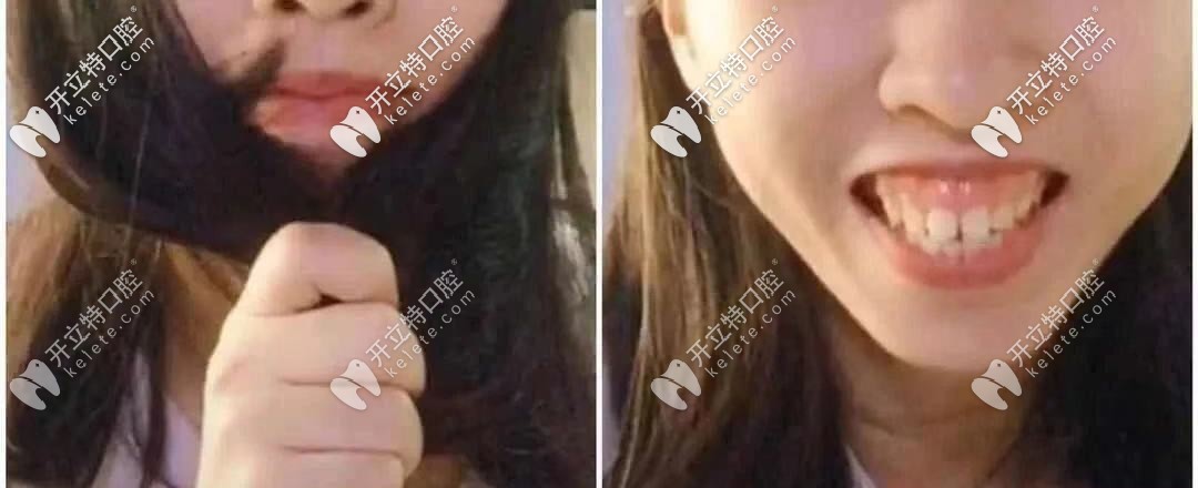 顏值是否也被封?。? border=