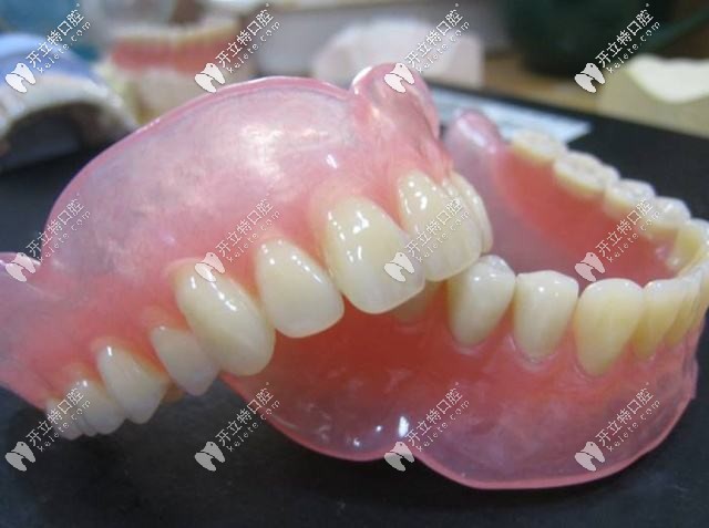 全口活動假牙圖示 全口活動假牙圖示