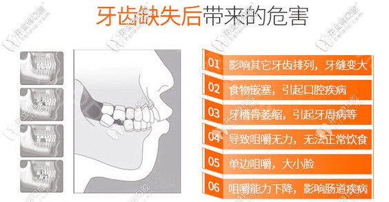種植牙將被再生牙取代?基因再生牙齒臨床仍遙遙無(wú)期