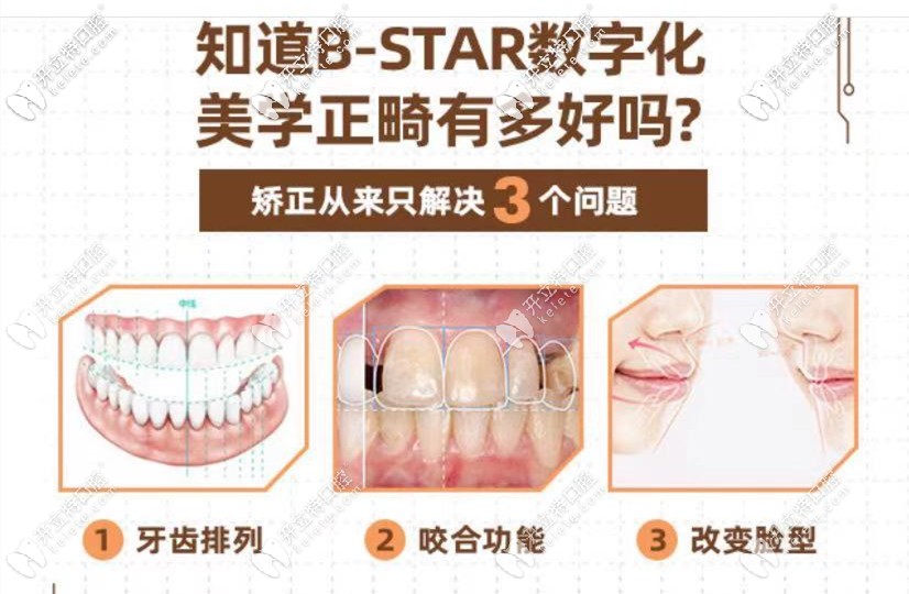 數(shù)字化矯正優(yōu)勢(shì)