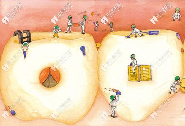 6000元、8000元、9000元甚至上萬元的種植牙有沒有區(qū)別