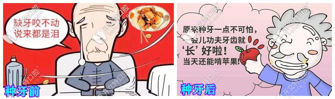 種牙前后對比 種牙前后對比